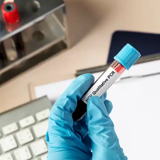 Hepatitis C Virus (HCV) Qualitative Real Time PCR